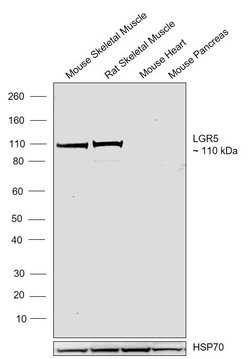 Invitrogen LGR5 Polyclonal Antibody 100 &mu;L; Unconjugated:Anticuerpos