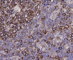 Invitrogen&trade;&nbsp;alpha Tubulin Polyclonal Antibody