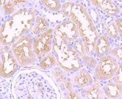 Invitrogen Dysferlin Polyclonal Antibody 100 &mu;L; Unconjugated:Antibodies,