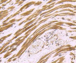 Invitrogen Dysferlin Polyclonal Antibody 100 &mu;L; Unconjugated:Antibodies,