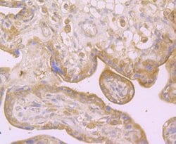 Invitrogen Dysferlin Polyclonal Antibody 100 &mu;L; Unconjugated:Antibodies,