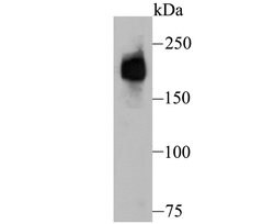 Invitrogen Dysferlin Polyclonal Antibody 100 &mu;L; Unconjugated:Antibodies,