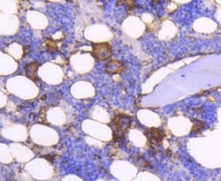 Invitrogen CD61 (Integrin beta 3) Polyclonal Antibody 100 &mu;L; Unconjugated:Antibodies,