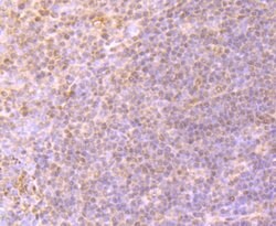 Invitrogen CD61 (Integrin beta 3) Polyclonal Antibody 100 &mu;L; Unconjugated:Antibodies,