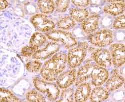 Invitrogen CD61 (Integrin beta 3) Polyclonal Antibody 100 &mu;L; Unconjugated:Antibodies,