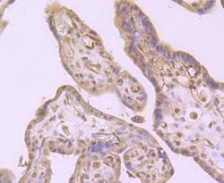 Invitrogen CD61 (Integrin beta 3) Polyclonal Antibody 100 &mu;L; Unconjugated:Antibodies,
