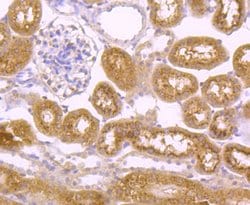 Invitrogen CD61 (Integrin beta 3) Polyclonal Antibody 100 &mu;L; Unconjugated:Antibodies,