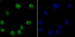 Invitrogen USP36 Polyclonal Antibody 100 &mu;L; Unconjugated:Antibodies,
