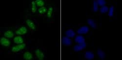 Invitrogen USP36 Polyclonal Antibody 100 &mu;L; Unconjugated:Antibodies,