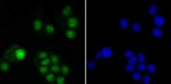 Invitrogen USP36 Polyclonal Antibody 100 &mu;L; Unconjugated:Antibodies,