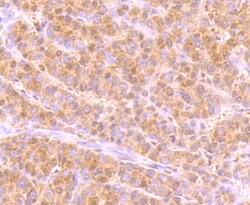 Invitrogen USP36 Polyclonal Antibody 100 &mu;L; Unconjugated:Antibodies,