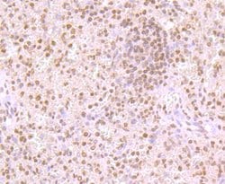 Invitrogen USP36 Polyclonal Antibody 100 &mu;L; Unconjugated:Antibodies,