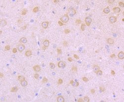 Invitrogen SCN10A Polyclonal Antibody 100 &mu;L; Unconjugated:Antibodies,