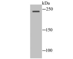 Invitrogen SCN10A Polyclonal Antibody 100 &mu;L; Unconjugated:Antibodies,