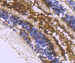 Invitrogen ZIP12 Polyclonal Antibody 100 &mu;L; Unconjugated:Antibodies,