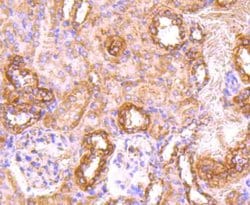 Invitrogen CD71 (Transferrin Receptor) Polyclonal Antibody 100 &mu;L; Unconjugated:Antibodies,