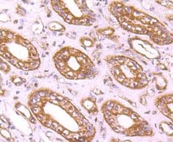 Invitrogen CD71 (Transferrin Receptor) Polyclonal Antibody 100 &mu;L; Unconjugated:Antibodies,