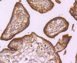 Invitrogen CD71 (Transferrin Receptor) Polyclonal Antibody 100 &mu;L; Unconjugated:Antibodies,