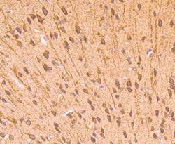 Invitrogen CD71 (Transferrin Receptor) Polyclonal Antibody 100 &mu;L; Unconjugated:Antibodies,