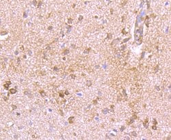 Invitrogen KV1.4 (KCNA4) Polyclonal Antibody 100 &mu;L; Unconjugated:Antibodies,