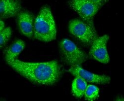 Invitrogen PPM1A Polyclonal Antibody 100 &mu;L; Unconjugated:Antibodies,