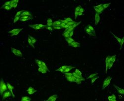 Invitrogen VCP Polyclonal Antibody 100 &mu;L | Buy Online | Invitrogen&trade; | Fisher Scientific