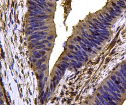 Invitrogen VCP Polyclonal Antibody 100 &mu;L | Buy Online | Invitrogen&trade; | Fisher Scientific