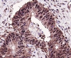 Invitrogen MSH6 Polyclonal Antibody 100 &mu;L; Unconjugated:Antibodies,
