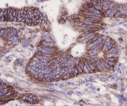 Invitrogen Integrin beta 1 (CD29) Polyclonal Antibody 100 &mu;L; Unconjugated:Antibodies,