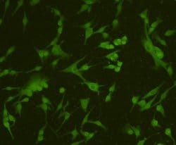 Invitrogen MGMT Polyclonal Antibody 100 &mu;L | Buy Online | Invitrogen&trade; | Fisher Scientific