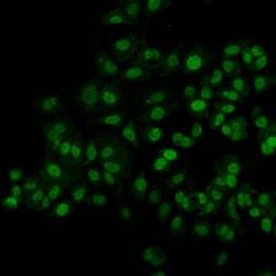 Invitrogen MGMT Polyclonal Antibody 100 &mu;L | Buy Online | Invitrogen&trade; | Fisher Scientific