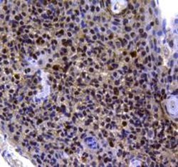 Invitrogen MGMT Polyclonal Antibody 100 &mu;L | Buy Online | Invitrogen&trade; | Fisher Scientific