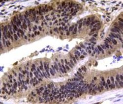 Invitrogen MGMT Polyclonal Antibody 100 &mu;L | Buy Online | Invitrogen&trade; | Fisher Scientific