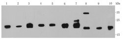 Invitrogen MGMT Polyclonal Antibody 100 &mu;L | Buy Online | Invitrogen&trade; | Fisher Scientific