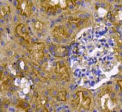 Invitrogen Pan Ras Polyclonal Antibody 100 &mu;L; Unconjugated:Antibodies,