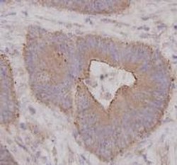 Invitrogen ROCK1 Polyclonal Antibody 100 &mu;L; Unconjugated:Antibodies,