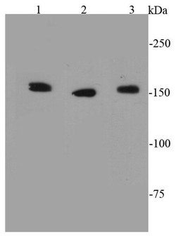 Invitrogen ROCK1 Polyclonal Antibody 100 &mu;L; Unconjugated:Antibodies,