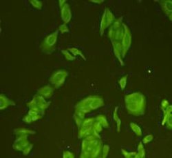 Invitrogen GAP43 Polyclonal Antibody 100 &mu;L | Buy Online | Invitrogen&trade; | Fisher Scientific