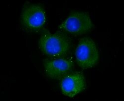 Invitrogen CD73 Polyclonal Antibody 100 &mu;L; Unconjugated:Antibodies,