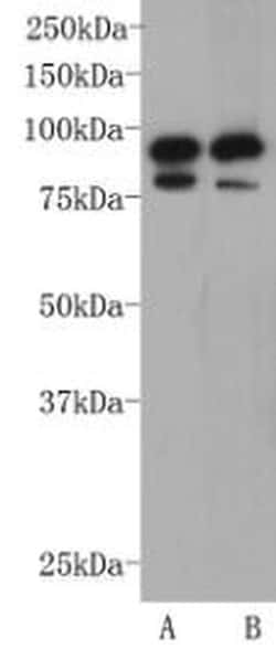 Invitrogen CD19 Polyclonal Antibody 100 &mu;L | Buy Online | Invitrogen&trade; | Fisher Scientific