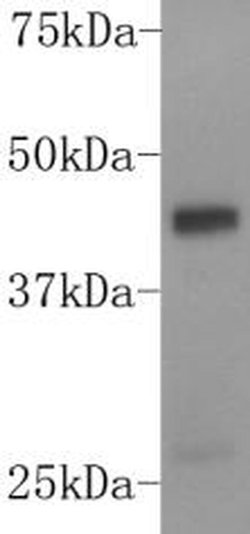 Invitrogen DUSP5 Polyclonal Antibody 100 &mu;L; Unconjugated:Antibodies,