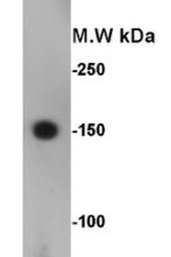 Invitrogen CD56 (NCAM) Polyclonal Antibody 100 &mu;L | Buy Online | Invitrogen&trade; | Fisher Scientific
