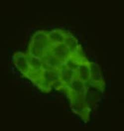 Invitrogen CD79a Polyclonal Antibody 100 &mu;L; Unconjugated:Antibodies,