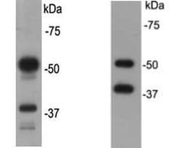 Invitrogen CD79a Polyclonal Antibody 100 &mu;L; Unconjugated:Antibodies,