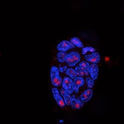 Invitrogen Nucleolin Polyclonal Antibody 100 &mu;L; Unconjugated:Antibodies,
