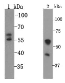 Invitrogen SLC18A1 Polyclonal Antibody 100 &mu;L; Unconjugated:Antibodies,