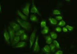 Invitrogen Vimentin Polyclonal Antibody 100 &mu;L; Unconjugated:Antibodies,