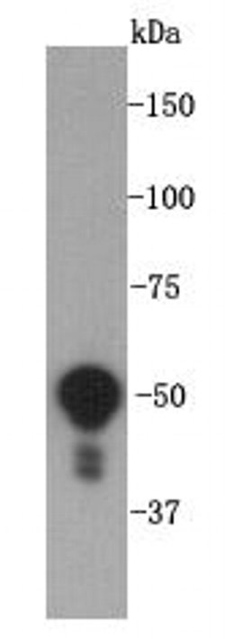 Invitrogen Vimentin Polyclonal Antibody 100 &mu;L; Unconjugated:Antibodies,