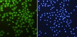 Invitrogen CDK2 Polyclonal Antibody 100 &mu;L; Unconjugated:Antibodies,