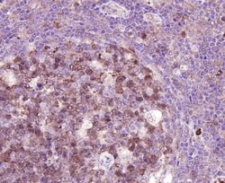 Invitrogen CDK2 Polyclonal Antibody 100 &mu;L; Unconjugated:Antibodies,